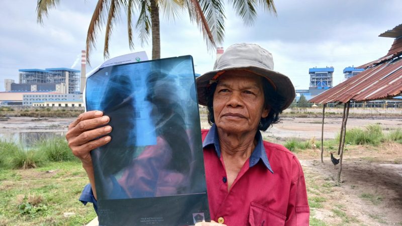 Samsuddin (65), warga Desa Tani Indah, Kecamatan Kapoiala, Konawe, menunjukkan hasil rontgen paru-parunya yang dipenuhi debu hitam diduga batubara. (Foto: Fadli Aksar)